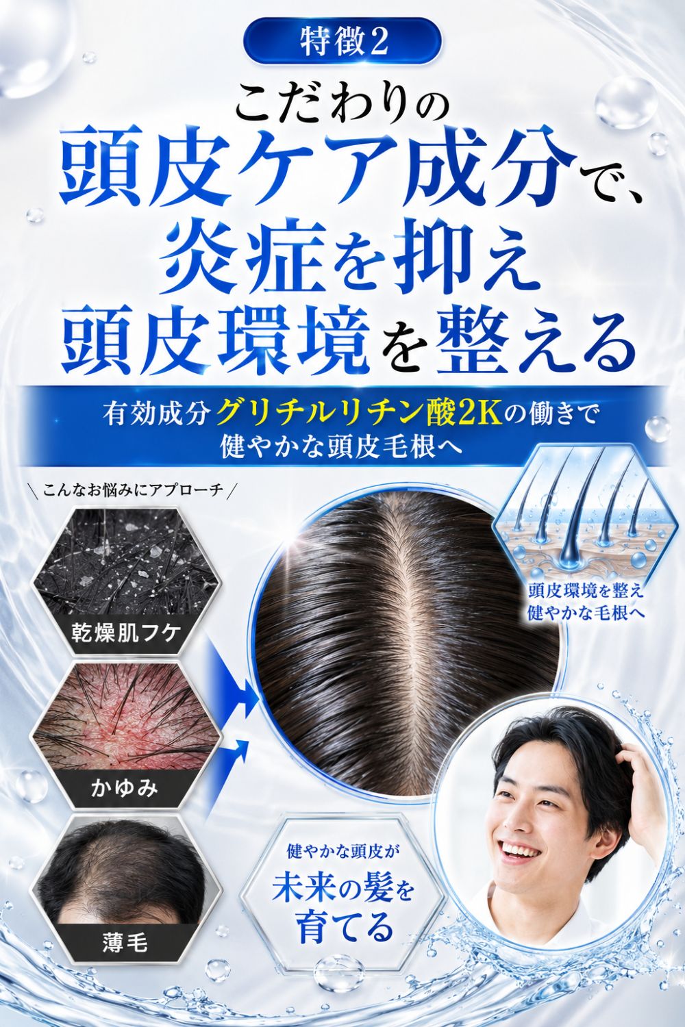 スカルプシャンプー メンズ アミノ酸 薬用 濃密泡 頭皮ケア 医薬部外品 男性用 日本製 スーパーサイヤ